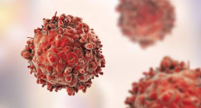 Why Individuals of Completely different Ages Want Completely different Most cancers Therapies